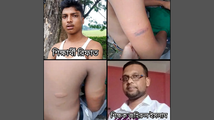 ‎পটুয়াখালীতে শিক্ষকের বিরুদ্ধে শিক্ষার্থীকে অমানবিক নির্যাতনের অভিযোগ